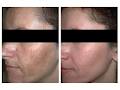 Kingston Laser Medispa image 6