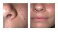 Kingston Laser and Cosmetic Clinic image 2