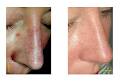 Kingston Laser and Cosmetic Clinic image 4