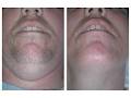 Kingston Laser and Cosmetic Clinic image 5