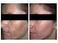 Kingston Laser and Cosmetic Clinic image 6