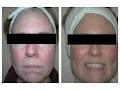 Kingston Laser and Cosmetic Clinic image 1