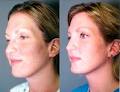 Laser Skin Care & Vein Clinic image 2