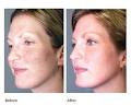 Laser Skin Care & Vein Clinic image 3