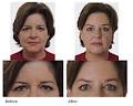 Laser Skin Care & Vein Clinic image 4