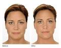 Laser Skin Care & Vein Clinic image 5