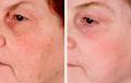 Laser Skin Care & Vein Clinic image 1