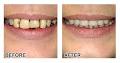 Nassar Costa - Denture Specialist image 2