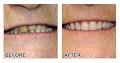 Nassar Costa - Denture Specialist image 3