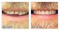 Nassar Costa - Denture Specialist image 4