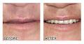 Nassar Costa - Denture Specialist image 1