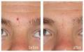 Nova Laser & Medical Aesthetics image 1