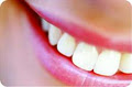 Ottawa Dentists- Dr. Dennis Kajiura Family Dentist in Ottawa image 4