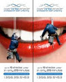 PearlBrite Canada Professional Teeth Whitening image 3