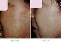 Skinworks-Dr. Frances Jang and Dr. Nick Carr image 3