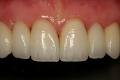 T M N Dental Lab Inc image 3
