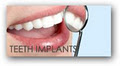 The Art of Smile Dental Clinic image 6