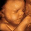 UC Baby image 4