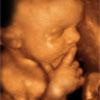 UC Baby image 1