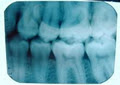 Vancouver Dental Spa image 4