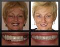 Waterdown Denture Clinic image 2