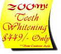 Zoom Teeth Whitening Calgary image 3