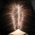 Lace Wigs Canada image 4