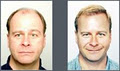 Seager Hair Transplant Centre image 5