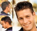 Sure Hair Transplants Kitchener image 1