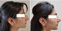Facial Cosmetic Surgery image 5