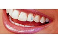 Sparkling Smiles Teeth Whitening & Jewelry image 2