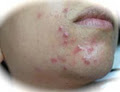 ACNE CLINIC "Miraculum" image 1