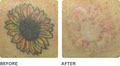Light Touch Laser Clinic image 4