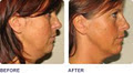 Light Touch Laser Clinic image 6