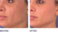 Light Touch Laser Clinic image 1