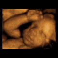 Tiny Hearts 3D Ultrasound Studio image 2