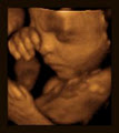 Tiny Hearts 3D Ultrasound Studio image 3