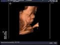 Ultrasound Preview LTD image 2