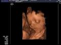 Ultrasound Preview LTD image 3