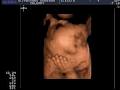 Ultrasound Preview LTD image 4