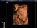 Ultrasound Preview LTD image 5