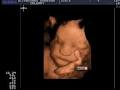 Ultrasound Preview LTD image 6