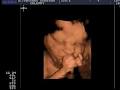 Ultrasound Preview LTD image 1