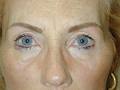 iBrows Permanent Makeup Toronto - Artist Pierre LY image 4
