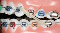 Align Orthodontics Sherwood Park image 4