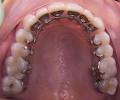 Clear Advantage Orthodontics image 6