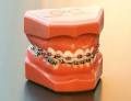 Clear Advantage Orthodontics logo