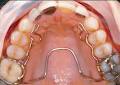Clear Orthodontic Solutions - Bankers Hall - Darin Ward, DDS, FAGD, FRDC(c) image 1