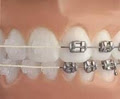 DR. WARREN COHEN, Orthodontic Specialist image 3