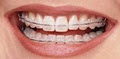 DR. WARREN COHEN, Orthodontic Specialist image 1